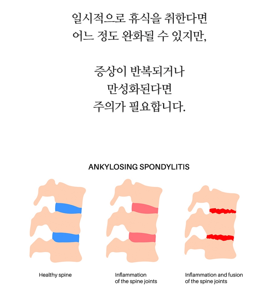 호매실신경외과 신경 통증, 정확한 원인 확인이 중요해요 04