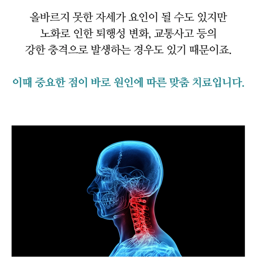 수원목통증 원인부터 정확하게 확인하세요 07