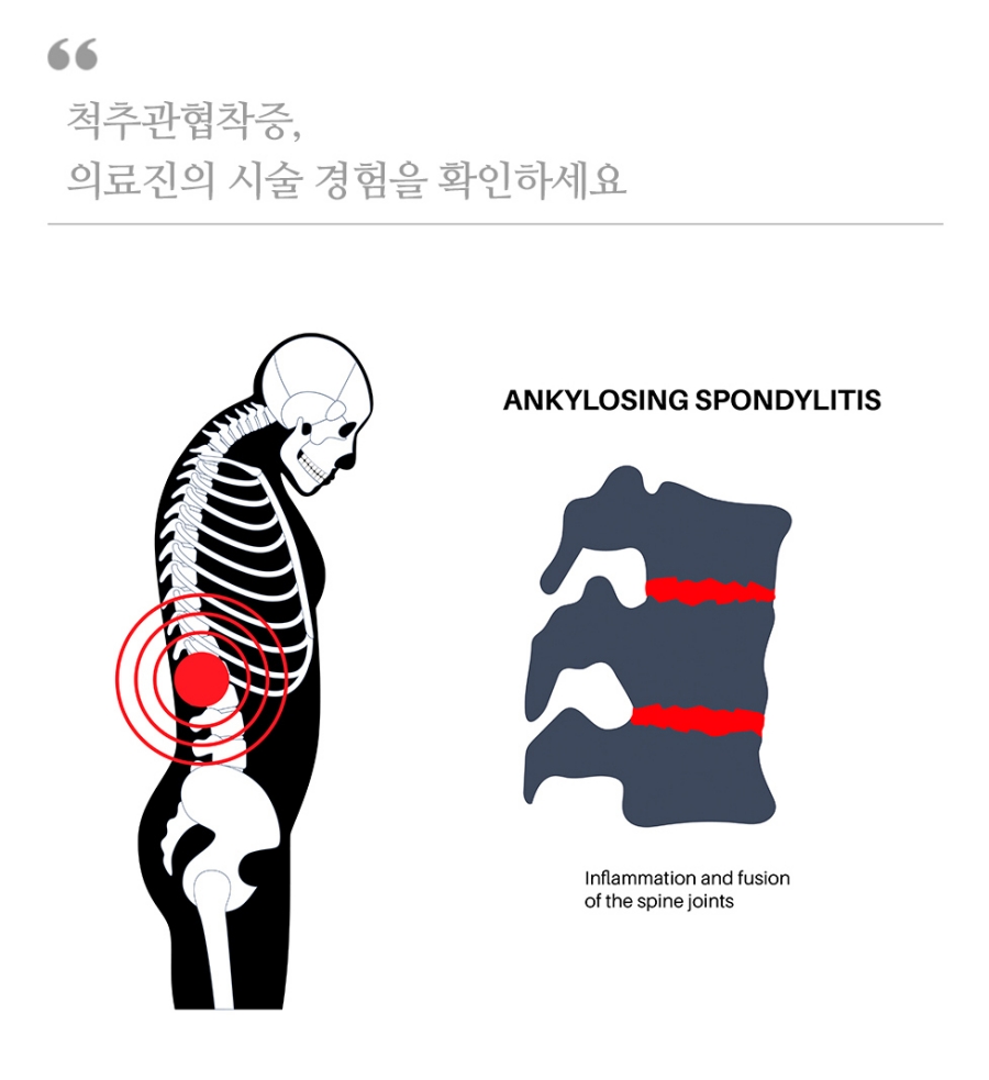 호매실신경외과 신경 통증, 정확한 원인 확인이 중요해요 07