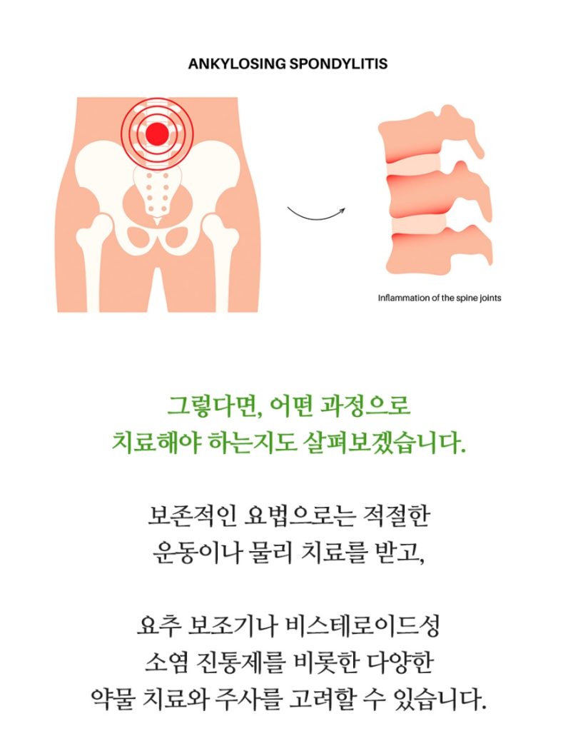 호매실신경외과 신경 통증, 정확한 원인 확인이 중요해요 18